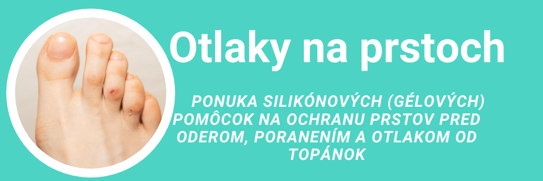 Otlaky na prstoch